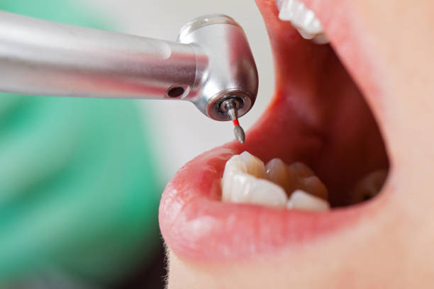 Emergency Dentist for Kids in TN